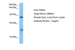 SMEK2 Antibody, Novus Biologicals 100 &mu;L; Unconjugated:Antibodies, Polyclonal